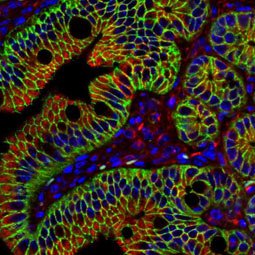 beta Catenin antibody [N1N2-2], N-term (GTX101435)